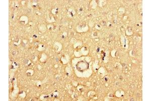 Immunohistochemistry of paraffin-embedded human brain tissue using ABIN7163908 at dilution of 1:100 (Pgap2 antibody  (AA 45-114))