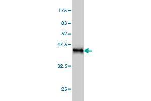 Western Blot detection against Immunogen (37. (KIF15 antibody  (AA 1279-1385))