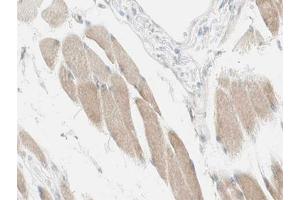 ABIN6266729 at 1/100 staining human Skeletal muscle tissue sections by IHC-P.