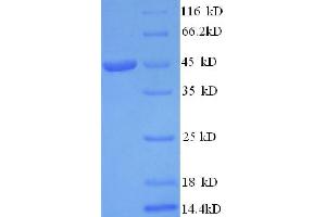 SDS-PAGE (SDS) image for Interleukin 1 alpha (IL1A) (AA 113-271), (full length) protein (GST tag) (ABIN7479623) (IL1A Protein (AA 113-271, full length) (GST tag))