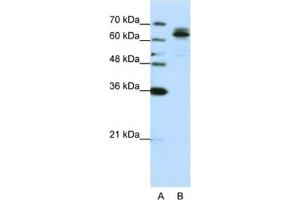Western Blotting (WB) image for anti-Fragile X Mental Retardation, Autosomal Homolog 1 (FXR1) antibody (ABIN2462084) (FXR1 antibody)