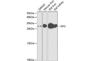 Western blot analysis of extracts of various cell lines using EPO Polyclonal Antibody at dilution of 1:500. (EPO antibody)