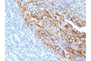 Formalin-fixed, paraffin-embedded human Tonsil stained with CD35 Mouse Monoclonal Antibody (To5). (CD35 antibody)