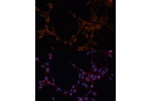 Immunofluorescence analysis of NIH/3T3 cells using  antibody (ABIN6127341, ABIN6136780, ABIN6136781 and ABIN6220209) at dilution of 1:100. (ALDH6A1 antibody  (AA 326-535))