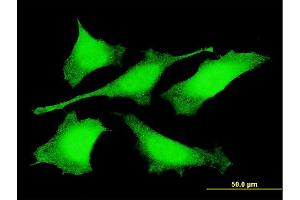 Immunofluorescence of monoclonal antibody to PRDM4 on HeLa cell. (PRDM4 antibody  (AA 476-575))