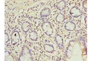 Immunohistochemistry of paraffin-embedded human small intestine tissue using ABIN7174997 at dilution of 1:100 (C9orf16 antibody  (AA 1-83))