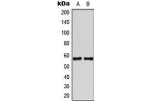 Western blot analysis of TBX22 expression in HeLa (A), Jurkat (B) whole cell lysates.