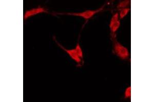 ABIN6274792 staining HT29 by IF/ICC. (EPHX4 antibody  (Internal Region))