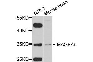 Western blot analysis of extracts of various cell lines, using MAGEA6 antibody.