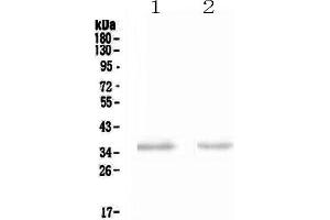 Western blot analysis of NCR1 using anti-NCR1 antibody .