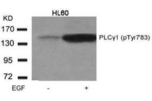 Image no. 1 for anti-phospholipase C, gamma 1 (PLCG1) (pTyr783) antibody (ABIN196793) (Phospholipase C gamma 1 antibody  (pTyr783))