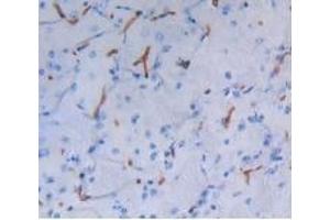Detection of ALB in Mouse Brain Tissue using Polyclonal Antibody to Albumin (ALB) (Albumin antibody)