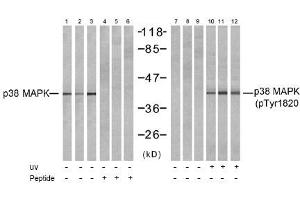 Image no. 1 for anti-Mitogen-Activated Protein Kinase 14 (MAPK14) (Tyr182) antibody (ABIN197497) (MAPK14 antibody  (Tyr182))