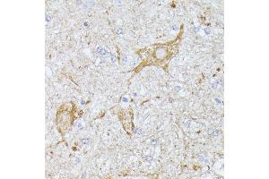 Immunohistochemistry of paraffin-embedded mouse spinal cord using TBCA antibody (ABIN6131384, ABIN6148884, ABIN6148885 and ABIN6216894) at dilution of 1:100 (40x lens). (TBCA antibody  (AA 1-108))