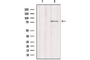 Western blot analysis of extracts from Hepg2, using RHG25 Antibody. (ARHGAP25 antibody  (Internal Region))