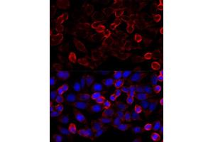 Immunofluorescence (IF) image for anti-Histone Deacetylase 6 (HDAC6) (AA 836-1104) antibody (ABIN6141681)