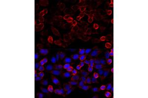 Immunofluorescence analysis of HeLa cells using HD antibody (ABIN6128054, ABIN6141681, ABIN6141684 and ABIN6215131) at dilution of 1:100 (40x lens). (HDAC6 antibody  (AA 836-1104))