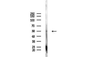 anti-Perilipin 1 (PLIN1) (pSer522) antibody