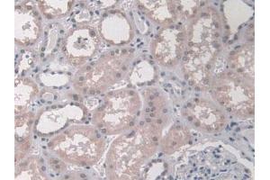 Detection of KLC1 in Human Kidney Tissue using Polyclonal Antibody to Kinesin Light Chain 1 (KLC1) (KLC1 antibody  (AA 1-254))