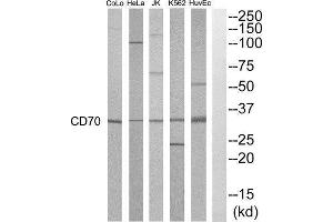 Western Blotting (WB) image for anti-CD70 Molecule (CD70) (Internal Region) antibody (ABIN1852540) (CD70 antibody  (Internal Region))