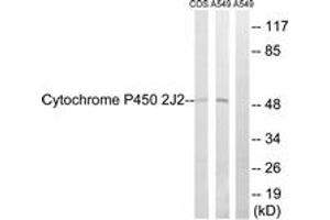 Western blot analysis of extracts from A549/COS7 cells, using Cytochrome P450 2J2 Antibody.