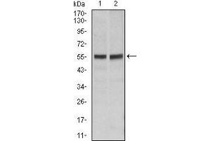 Western blot analysis using FAS mouse mAb against Hela (1), Jurkat (2) cell lysate. (FAS antibody)