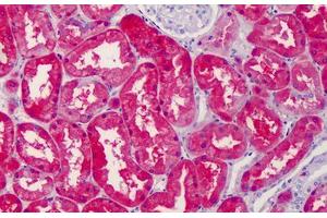 Human Kidney: Formalin-Fixed, Paraffin-Embedded (FFPE) (RAE1 antibody  (C-Term))