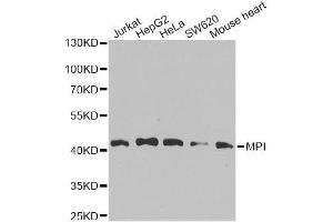 Western blot analysis of extracts of various cell lines, using MPI antibody. (MPI antibody  (AA 1-423))
