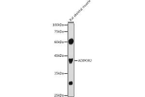 Western blot analysis of extracts of Rat skeletal muscle, using  antibody (ABIN6127413, ABIN6136583, ABIN6136584 and ABIN6216527) at 1:1000 dilution. (Adiponectin Receptor 2 antibody  (AA 1-80))