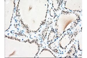 Immunohistochemical staining of paraffin-embedded Human Kidney tissue using anti-USP5 mouse monoclonal antibody. (USP5 antibody)