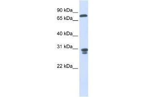 NIT2 antibody used at 1 ug/ml to detect target protein. (NIT2 antibody  (Middle Region))