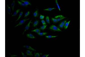 Immunofluorescence staining of Hela Cells with ABIN7127446 at 1:50, counter-stained with DAPI. (Recombinant CYP17A1 antibody)