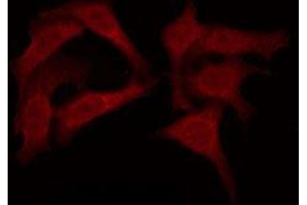 OR11G2 antibody  (C-Term)
