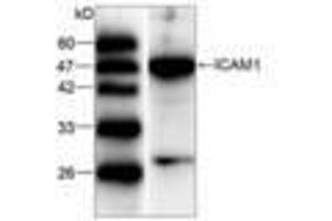 Image no. 1 for anti-Intercellular Adhesion Molecule 1 (ICAM1) (AA 301-532) antibody (ABIN791496) (ICAM1 antibody  (AA 301-532))