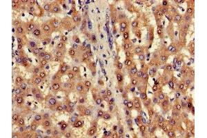 Immunohistochemistry of paraffin-embedded human liver tissue using ABIN7153223 at dilution of 1:100 (FUOM antibody  (AA 1-134))