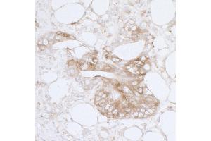 Immunohistochemistry (IHC) image for anti-Major Vault Protein (MVP) (AA 1-50) antibody (ABIN7455064)