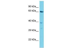 Host: Rabbit  Target Name: Vps45  Sample Tissue: Mouse Lung lysates  Antibody Dilution: 1. (VPS45 antibody  (C-Term))