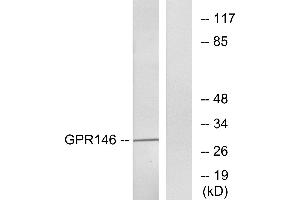 Western blot analysis of extracts from LOVO cells, using GPR146 antibody. (GPR146 antibody  (Internal Region))