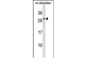 Mouse Il27 Antibody (Center) (ABIN1537798 and ABIN2838314) western blot analysis in mouse bladder tissue lysates (35 μg/lane). (IL-27 antibody  (AA 124-150))