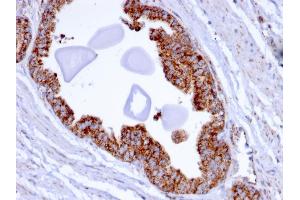 Immunohistochemistry (IHC) image for anti-Prostate Transmembrane Protein, Androgen Induced 1 (PMEPA1) antibody (ABIN6940417)