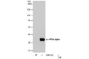 IP Image Immunoprecipitation of PP2A alpha protein from 293T whole cell extracts using 5 μg of PP2A alpha antibody, Western blot analysis was performed using PP2A alpha antibody, EasyBlot anti-Rabbit IgG  was used as a secondary reagent.