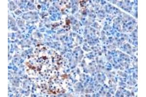 Immunohistochemistry (IHC) image for anti-Interferon Induced with Helicase C Domain 1 (IFIH1) (N-Term) antibody (ABIN2465934) (IFIH1 antibody  (N-Term))