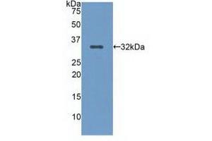 Detection of Recombinant LRP5, Human using Polyclonal Antibody to Low Density Lipoprotein Receptor Related Protein 5 (LRP5) (LRP5 antibody  (AA 769-1016))