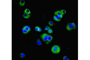 Immunofluorescent analysis of MCF-7 cells using ABIN7171040 at dilution of 1:100 and Alexa Fluor 488-congugated AffiniPure Goat Anti-Rabbit IgG(H+L) (SUSD6 (AA 144-303) antibody)