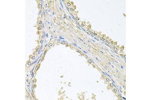 Immunohistochemistry of paraffin-embedded human prostate using PMM2 antibody at dilution of 1:100 (x40 lens). (PMM2 antibody)