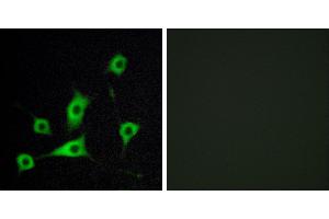 Peptide - +Immunohistochemistry analysis of paraffin-embedded human lung carcinoma tissue, using CRBP III antibody. (Retinol Binding Protein 5 antibody)