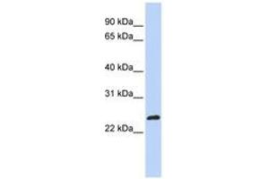 Image no. 1 for anti-MAX-Like Protein X (MLX) (AA 180-229) antibody (ABIN6744265) (MLX antibody  (AA 180-229))