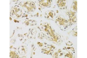 Immunohistochemistry of paraffin-embedded Human breast using Caspase-2 Polyclonal Antibody at dilution of 1:100 (40x lens). (Caspase 2 antibody)