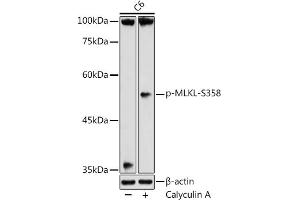 Western blot analysis of extracts of C6 cells, using Phospho-MLKL-S358 antibody (ABIN7268671) at 1:500 dilution. (MLKL antibody  (pSer358))