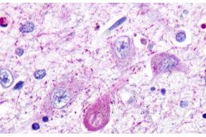 Image no. 1 for anti-Trace Amine Associated Receptor 5 (TAAR5) (Cytoplasmic Domain) antibody (ABIN1049383) (TAAR5 antibody  (Cytoplasmic Domain))